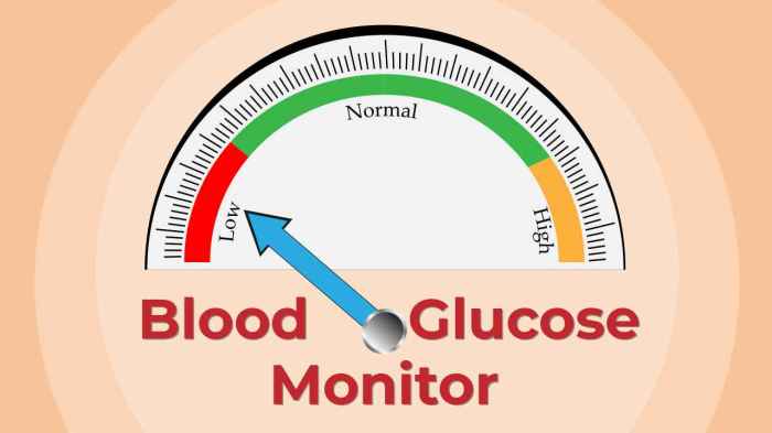 Which of the following statements is true of hypoglycemia